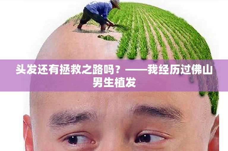 头发还有拯救之路吗？——我经历过佛山男生植发