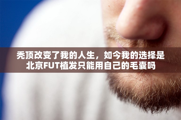 秃顶改变了我的人生，如今我的选择是北京FUT植发只能用自己的毛囊吗