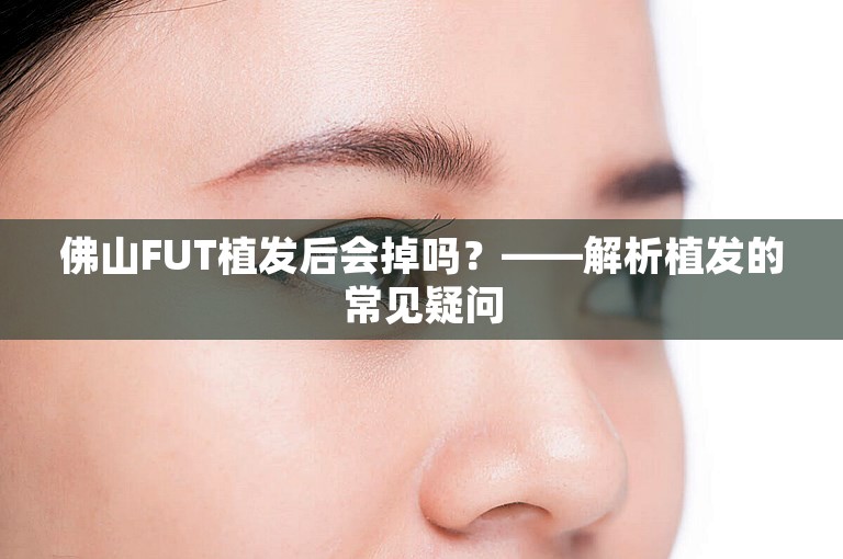 佛山FUT植发后会掉吗？——解析植发的常见疑问