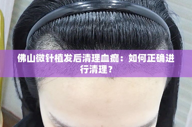 佛山微针植发后清理血痂：如何正确进行清理？