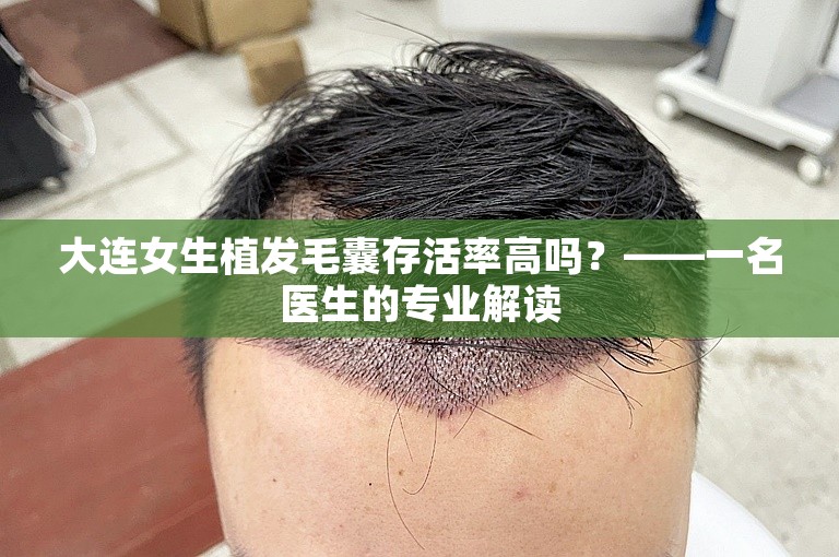 大连女生植发毛囊存活率高吗？——一名医生的专业解读