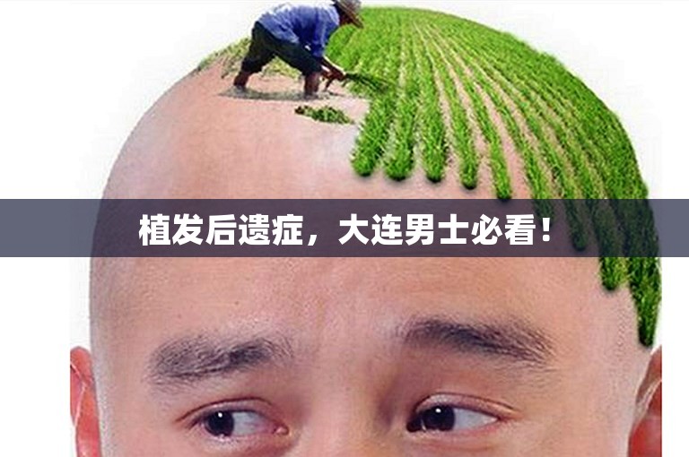 植发后遗症，大连男士必看！