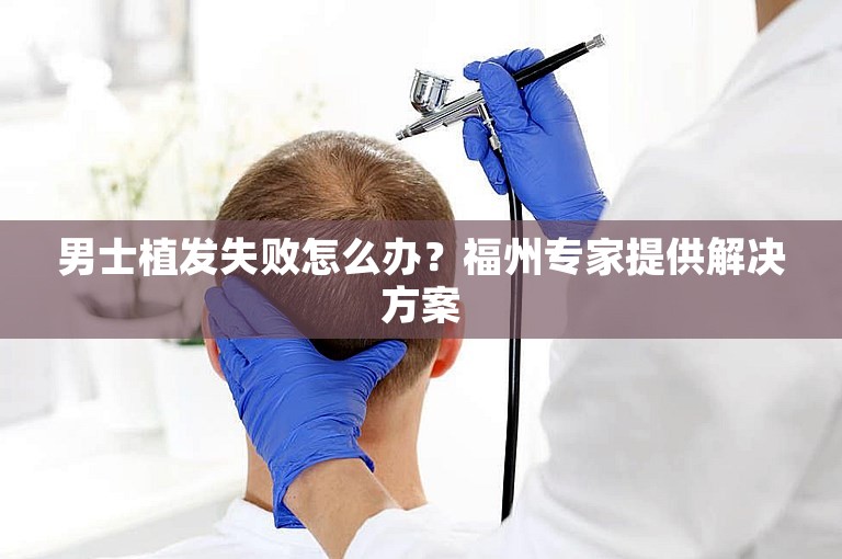 男士植发失败怎么办？福州专家提供解决方案