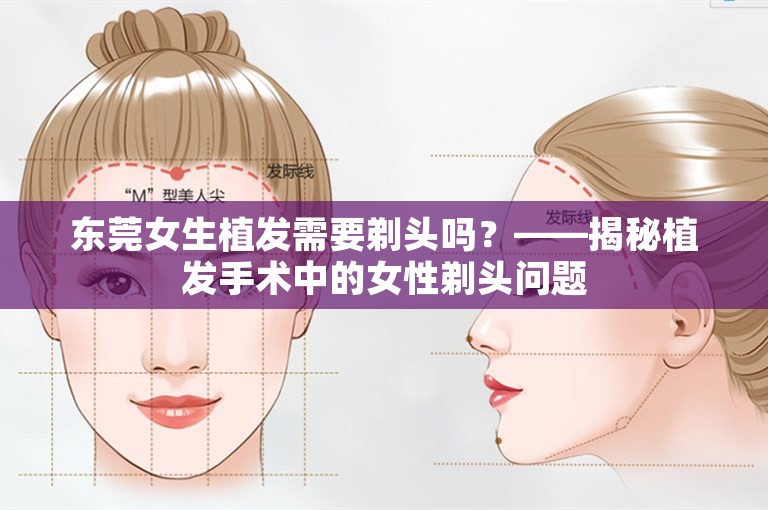 东莞女生植发需要剃头吗？——揭秘植发手术中的女性剃头问题