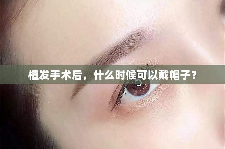 植发手术后，什么时候可以戴帽子？