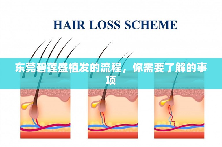 东莞碧莲盛植发的流程，你需要了解的事项