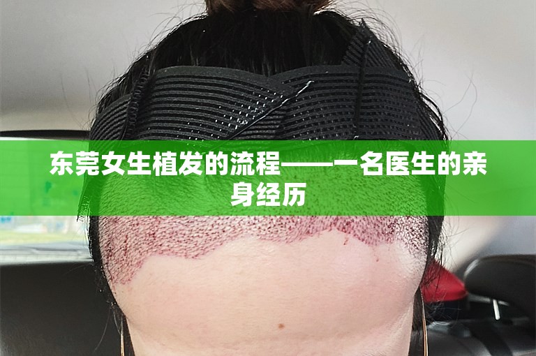 东莞女生植发的流程——一名医生的亲身经历