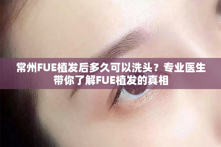 常州FUE植发后多久可以洗头？专业医生带你了解FUE植发的真相