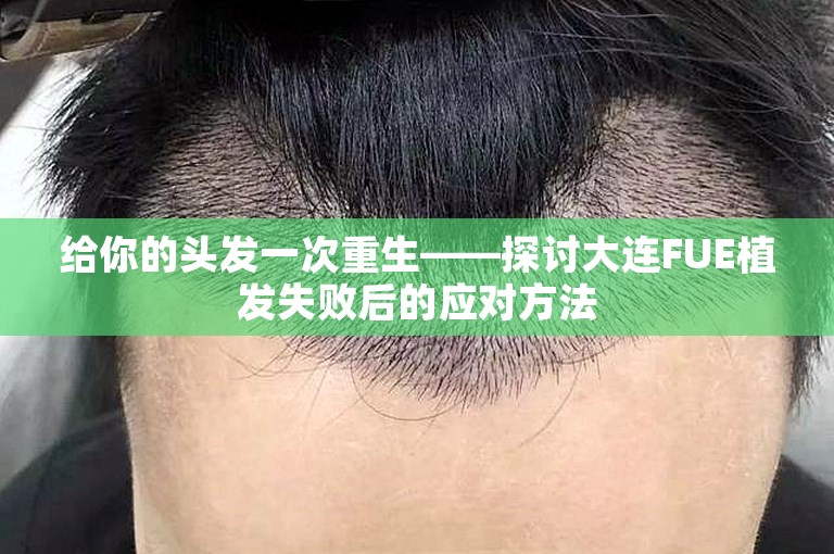 给你的头发一次重生——探讨大连FUE植发失败后的应对方法