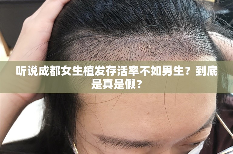 听说成都女生植发存活率不如男生？到底是真是假？