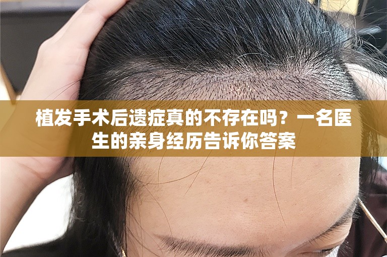 植发手术后遗症真的不存在吗？一名医生的亲身经历告诉你答案