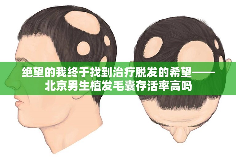 绝望的我终于找到治疗脱发的希望——北京男生植发毛囊存活率高吗