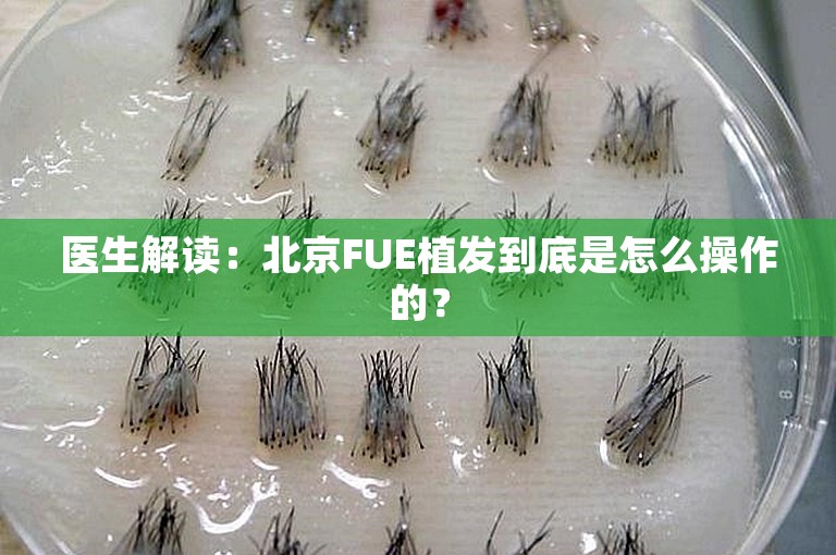 医生解读：北京FUE植发到底是怎么操作的？