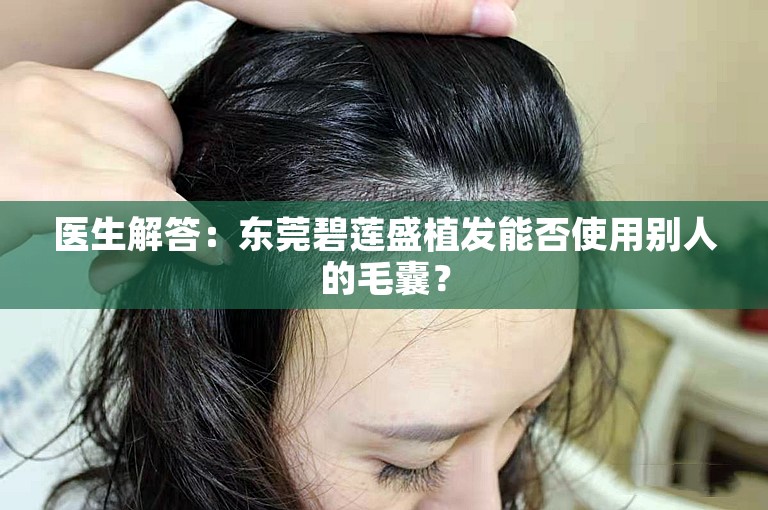 医生解答：东莞碧莲盛植发能否使用别人的毛囊？