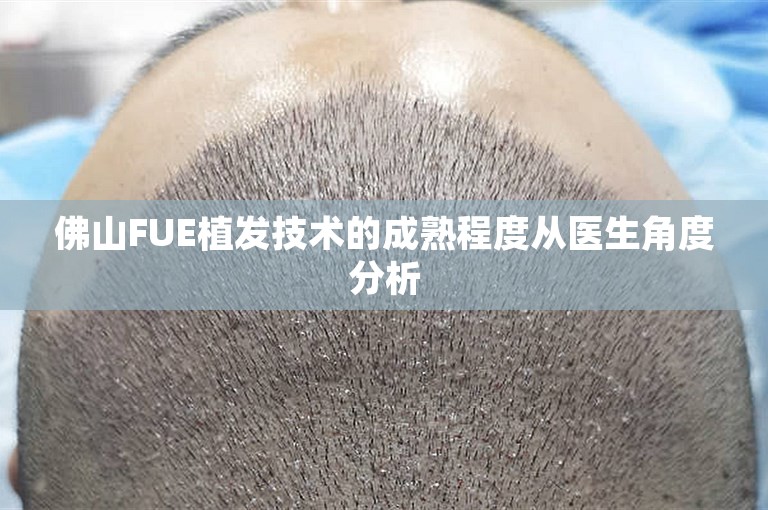 佛山FUE植发技术的成熟程度从医生角度分析