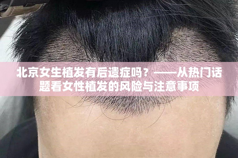 北京女生植发有后遗症吗？——从热门话题看女性植发的风险与注意事项