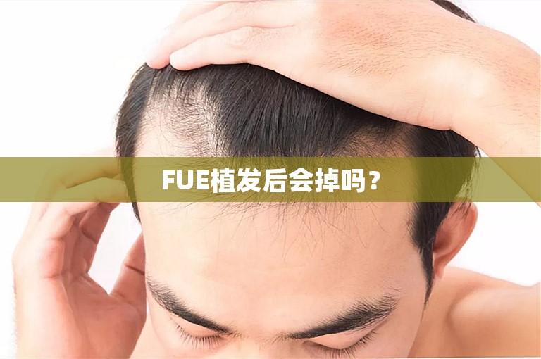 FUE植发后会掉吗？