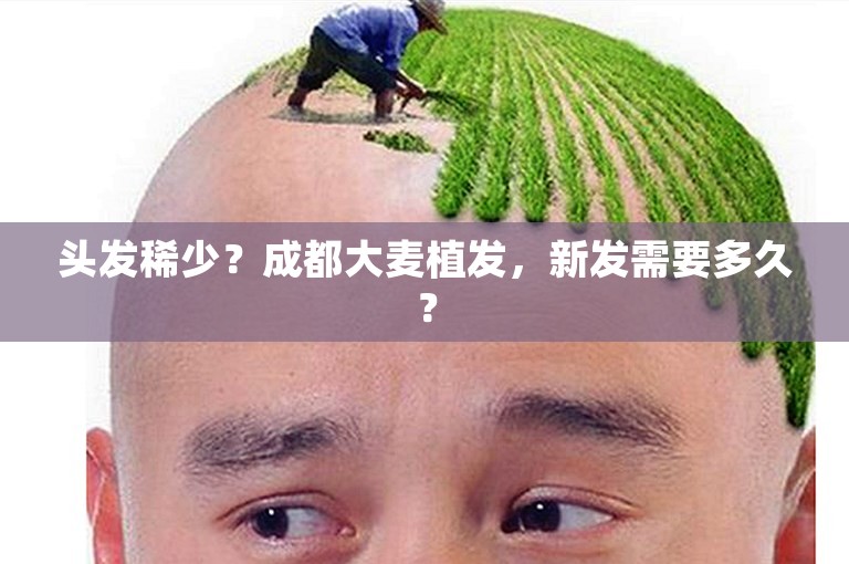 头发稀少？成都大麦植发，新发需要多久？