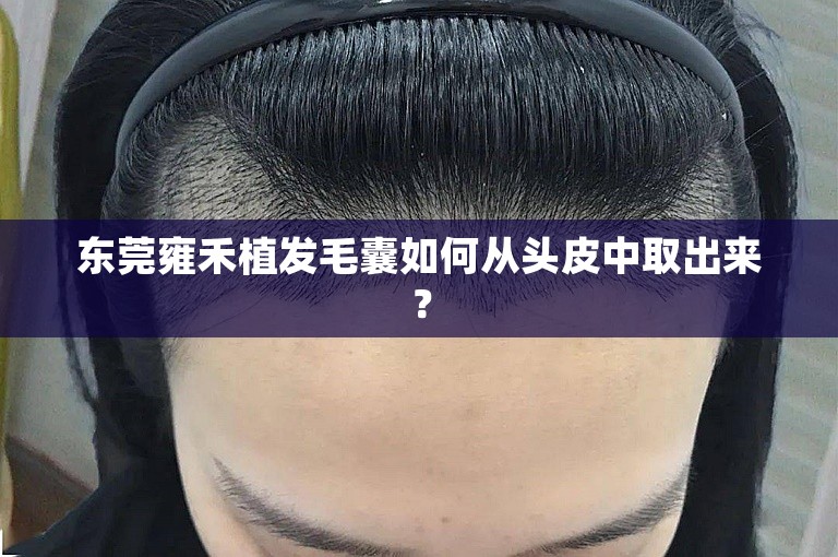 东莞雍禾植发毛囊如何从头皮中取出来？