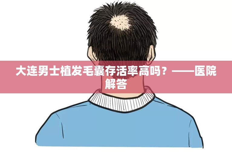 大连男士植发毛囊存活率高吗？——医院解答