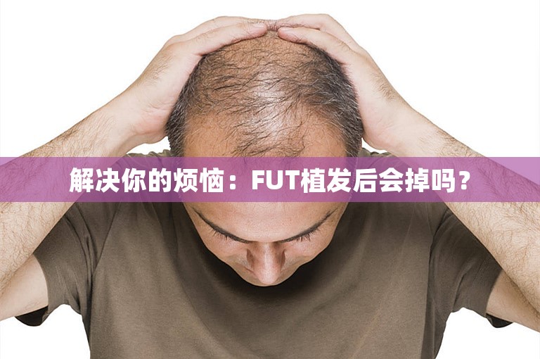 解决你的烦恼：FUT植发后会掉吗？