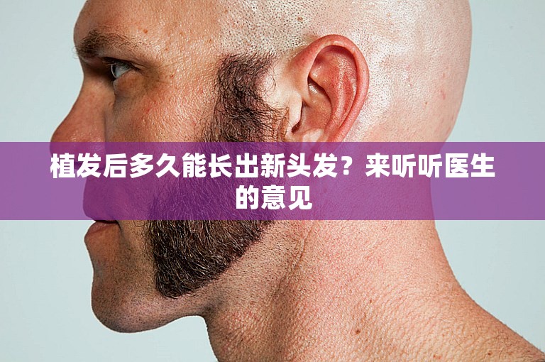 植发后多久能长出新头发？来听听医生的意见