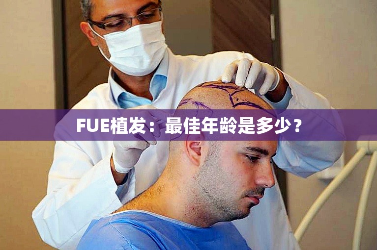 FUE植发：最佳年龄是多少？