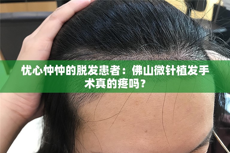 忧心忡忡的脱发患者：佛山微针植发手术真的疼吗？