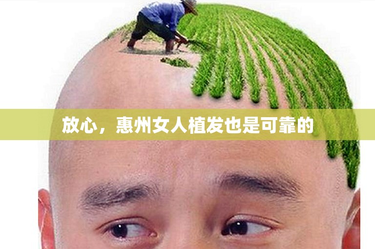 放心，惠州女人植发也是可靠的