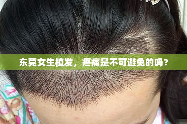 东莞女生植发，疼痛是不可避免的吗？