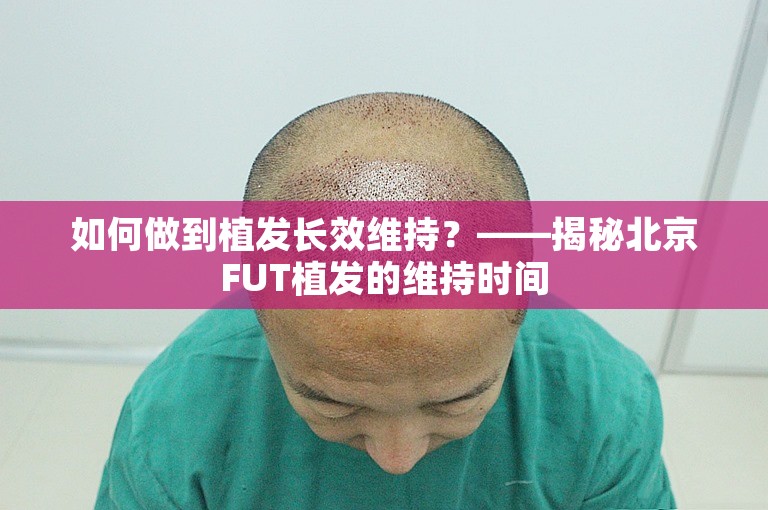 如何做到植发长效维持？——揭秘北京FUT植发的维持时间