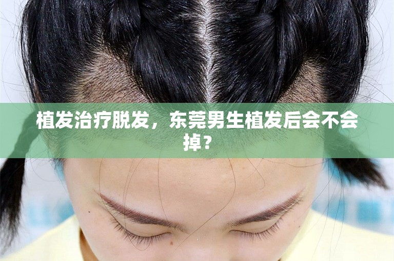 植发治疗脱发，东莞男生植发后会不会掉？