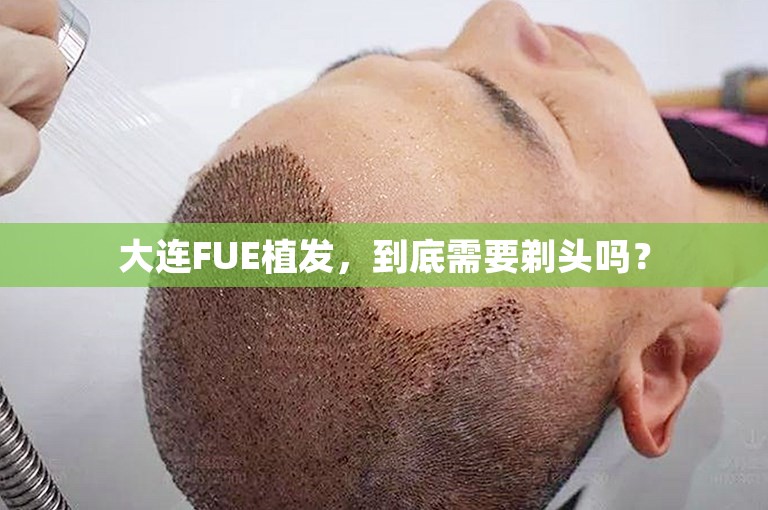 大连FUE植发，到底需要剃头吗？