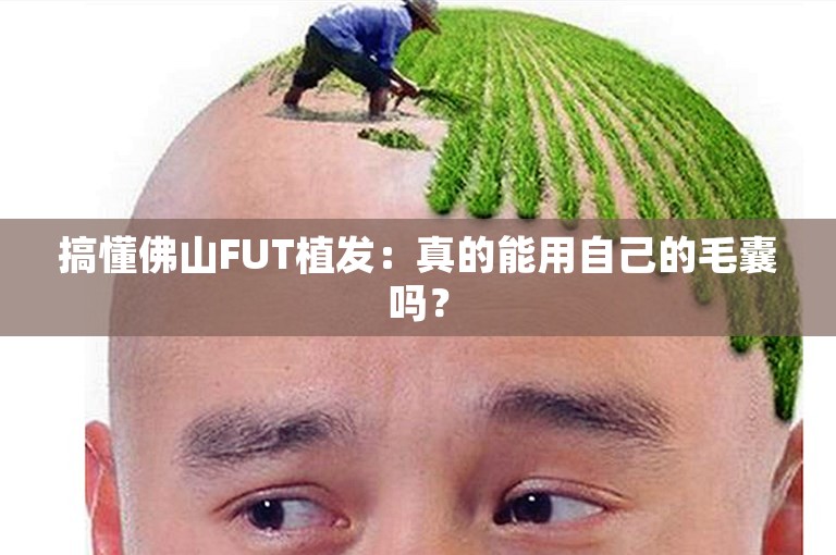 搞懂佛山FUT植发：真的能用自己的毛囊吗？