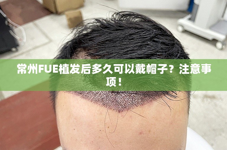 常州FUE植发后多久可以戴帽子？注意事项！