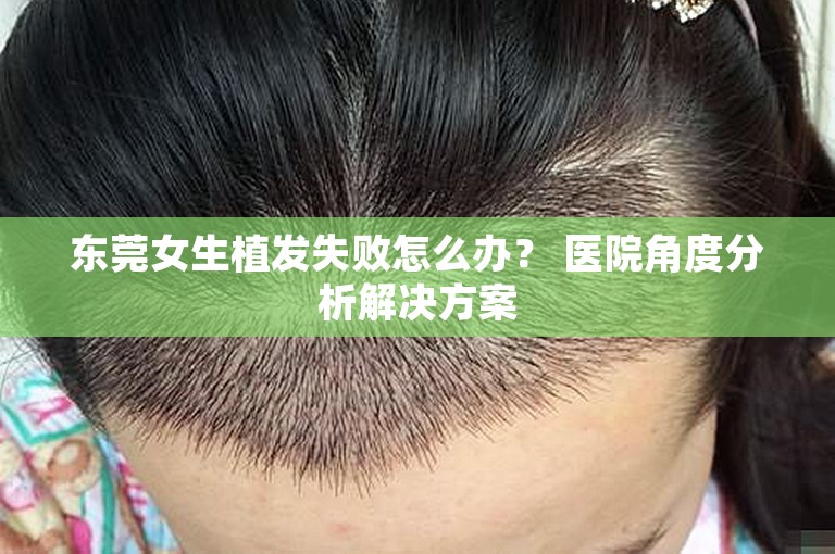 东莞女生植发失败怎么办？ 医院角度分析解决方案