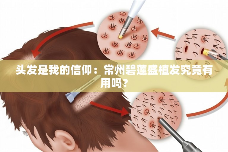 头发是我的信仰：常州碧莲盛植发究竟有用吗？