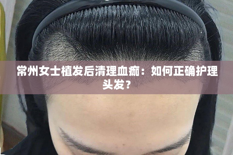 常州女士植发后清理血痂：如何正确护理头发？