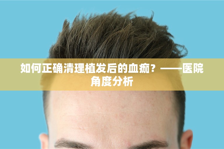 如何正确清理植发后的血痂？——医院角度分析