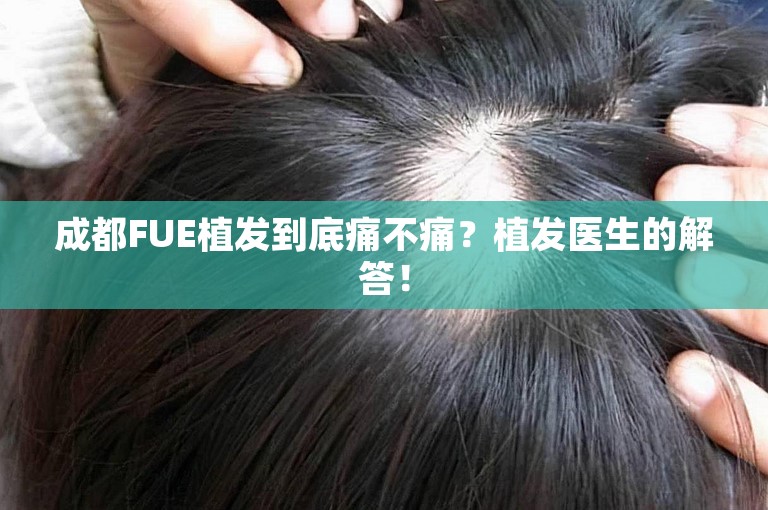 成都FUE植发到底痛不痛？植发医生的解答！