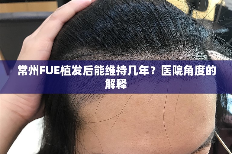 常州FUE植发后能维持几年？医院角度的解释