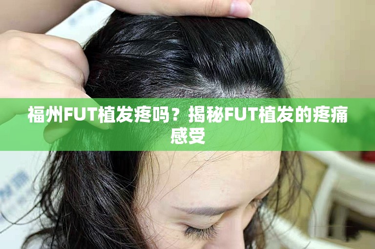 福州FUT植发疼吗？揭秘FUT植发的疼痛感受