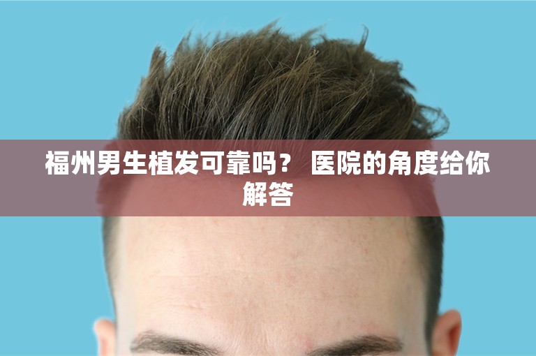 福州男生植发可靠吗？ 医院的角度给你解答