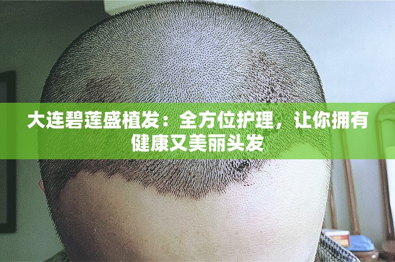 大连碧莲盛植发：全方位护理，让你拥有健康又美丽头发