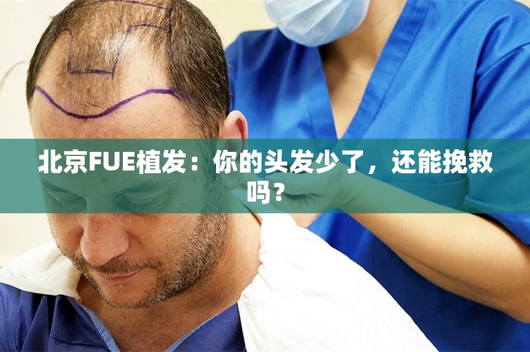 北京FUE植发：你的头发少了，还能挽救吗？