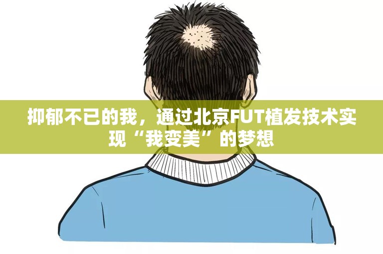 抑郁不已的我，通过北京FUT植发技术实现“我变美”的梦想