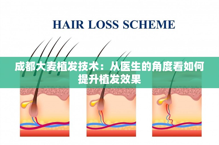 成都大麦植发技术：从医生的角度看如何提升植发效果