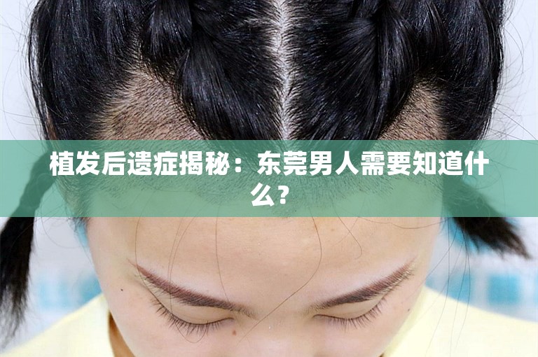 植发后遗症揭秘：东莞男人需要知道什么？