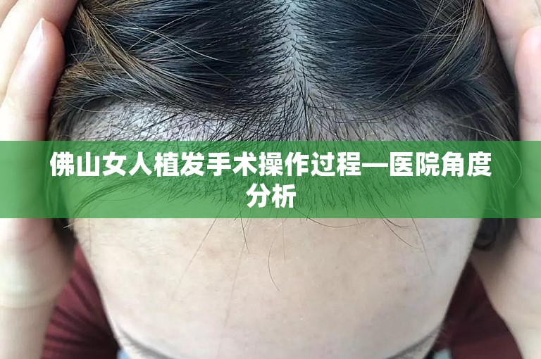 佛山女人植发手术操作过程—医院角度分析