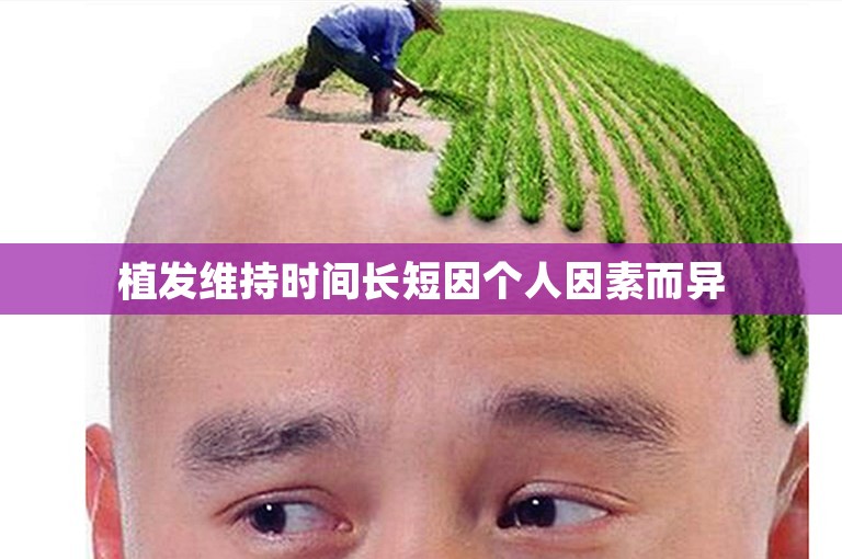 植发维持时间长短因个人因素而异